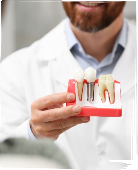 Smiling dentist holding a model of a dental implant