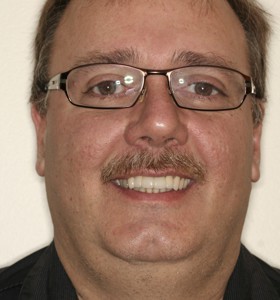 Replaced Anterior Bridge – Better Look & Fit